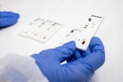 Unhas mans con luvas azuis suxeitan un test. CONCELLO DE ZARAGOZA / MIGUEL G. GARCÍA