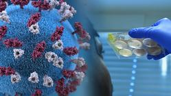 Detección do coronavirus SARS-CoV-2, causante da covid-19, mediante PCR en tempo real (RT-PCR) / OIEA - Organismo Internacional de Enerxía Atómica. 